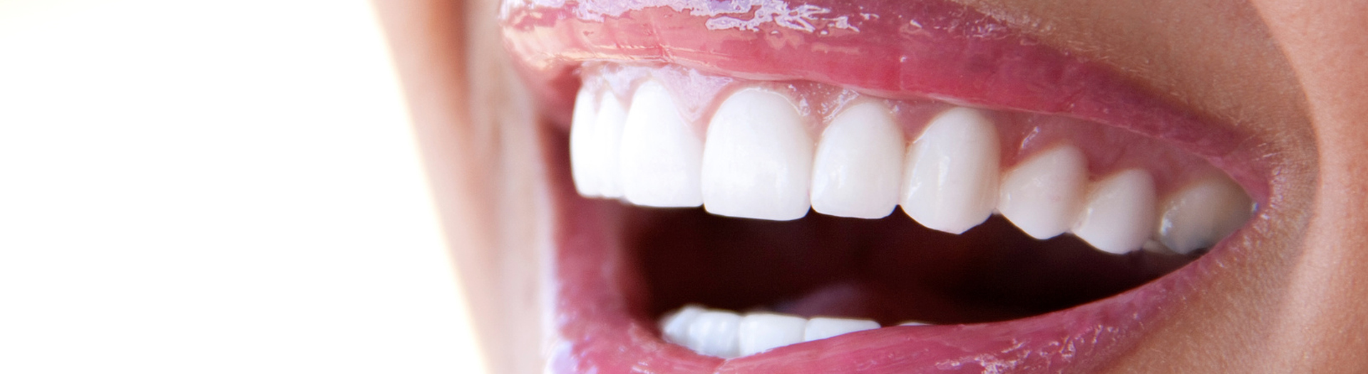 Battlefords Dental Centre female hygenist cleaning