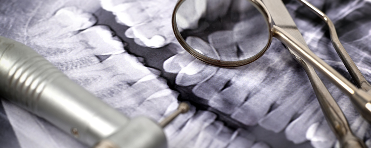 x ray and medical tools dental teeth
